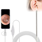 i95 3 in 1 USB Ear Scope Inspection HD 0.3MP Camera Visual Ear Spoon for OTG Android Phones & PC & MacBook, 1.75m Length Cable, 3 in 1 White 0.3MP 3 in 1 White 0.3MP White