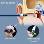 i95 3 in 1 USB Ear Scope Inspection HD 0.3MP Camera Visual Ear Spoon for OTG Android Phones & PC & MacBook, 1.75m Length Cable, 3 in 1 White 0.3MP