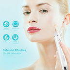 Xpreen XPRE061 Professional Dark Spot Remover Freckle Tattoo Chargeable Wart Mole Remover, with LED Screen and Spotlight – TPU