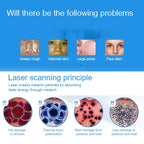 Handheld Picosecond Portable (Removing Tattoo Freckle Mole Dot) Machine Laser Plasma Beauty Care Pen, USB / Blue Light, USB / Red Light