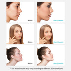 Xpreen Rechargeable Pore Cleanser Home Facial Beauty Device with LED Screen & 4 Probes, XPRE111