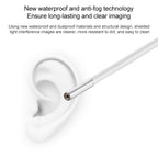 Supereyes Y001 Ear Mite Mouth Electronic Digital Fixed Focus Endoscope, Y001
