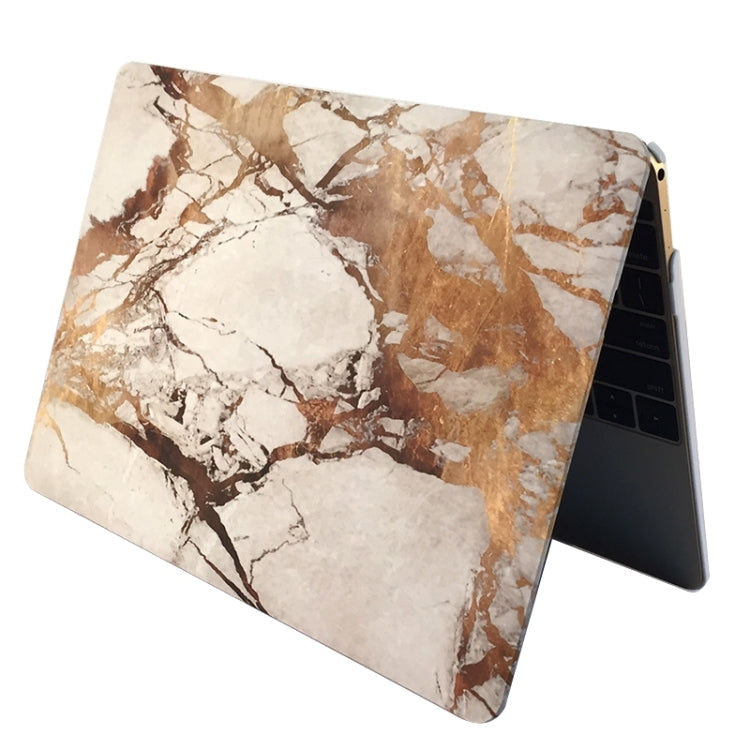 Protective Case – 13.3" Screen (Macbook Pro 13) #2
