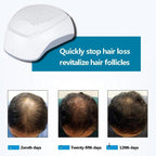 Laser Therapy Hair Growth Helmet Anti Hair Loss Treatment Device