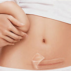 Organic silicone Gel Scar Therapy Patch be Washed and Reused
