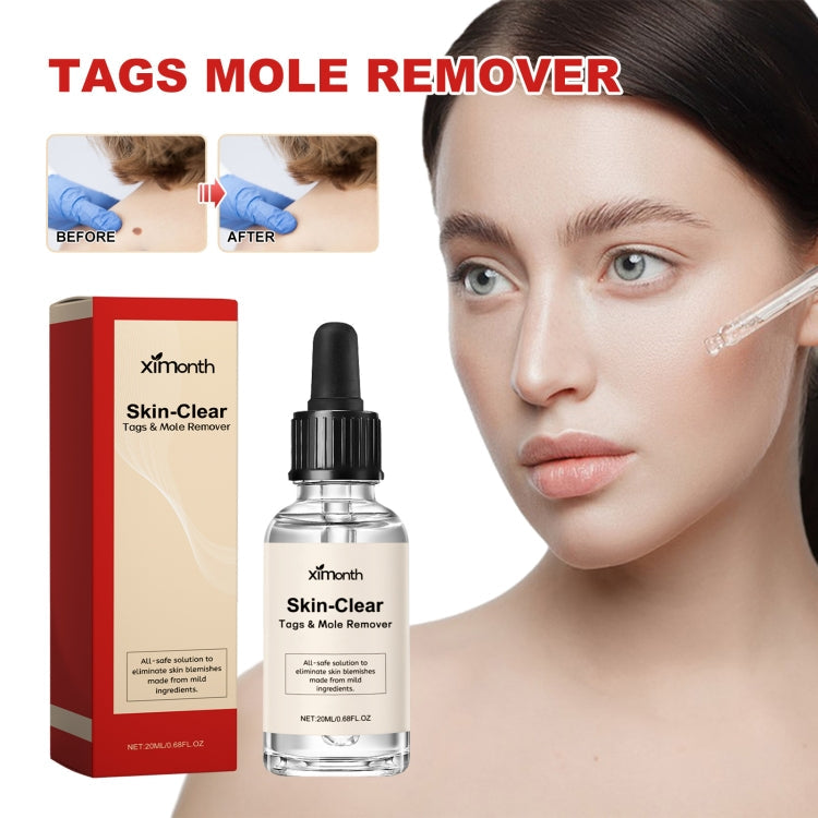 Ximonth 20ml/Bottle Anti Mole And Wart Liquid Dark Spot Tag Remover Skin Essence Default Title
