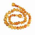 Adult Bees Knees Raw Honey Baltic Amber Anklet 27cm (L XL Adult Ankle)