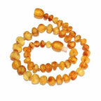 Adult Bees Knees Raw Honey Baltic Amber Anklet 27cm (L XL Adult Ankle)