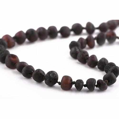 Adult Cherryaid Raw Dark Cherry Baltic Amber Necklace