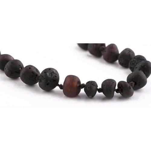 Adult Cherryaid Raw Dark Cherry Baltic Amber Necklace