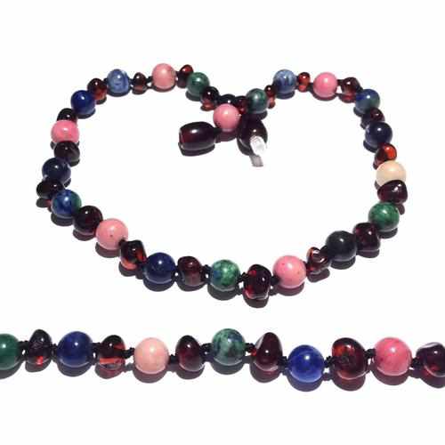 Adult Earthchild Cherry Baltic Amber Gemstone Anklet