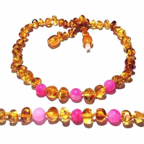 Adult Honeysuckle Polished Honey Baltic Amber Pink Agate Anklet 26cm (L Adult Ankle)