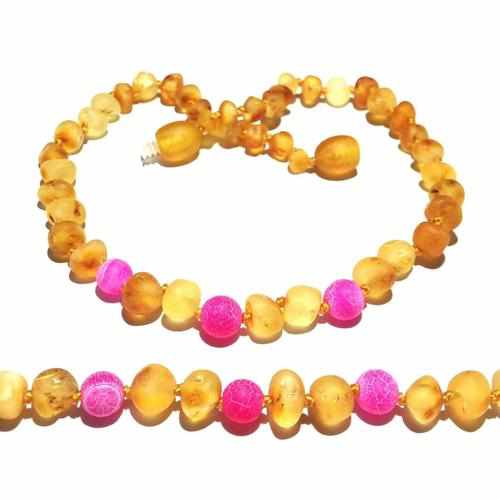 Adult Nurture Raw Honey Pink Agate Baltic Amber Bead Anklet 26cm (L Adult Ankle)