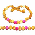 Adult Nurture Raw Honey Pink Agate Baltic Amber Bead Anklet 26cm (L Adult Ankle)