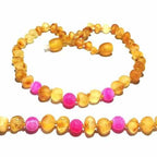 Adult Nurture Raw Honey Pink Agate Baltic Amber Bead Anklet 26cm (L Adult Ankle)