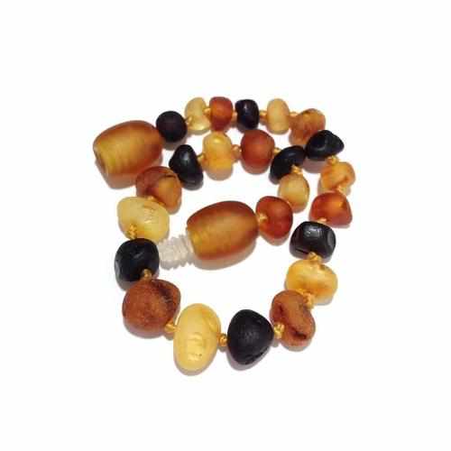 Adult Shingle Raw Mixed Baltic Amber Anklet