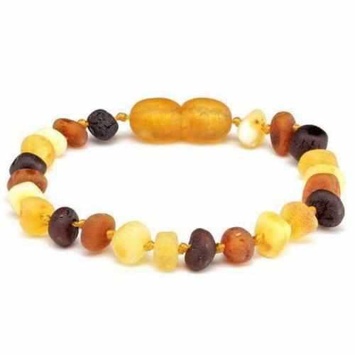 Adult Shingle Raw Mixed Baltic Amber Anklet
