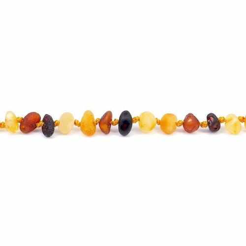 Adult Shingle Raw Mixed Baltic Amber Anklet