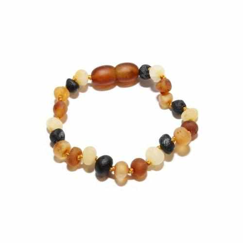 Adult Shingle Raw Mixed Baltic Amber Anklet