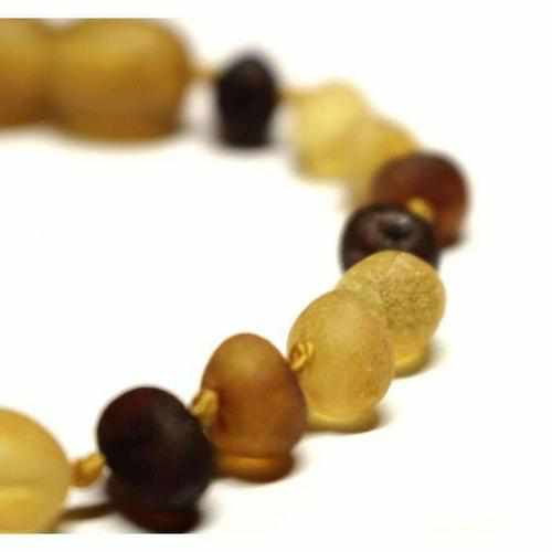 Adult Shingle Raw Mixed Baltic Amber Anklet