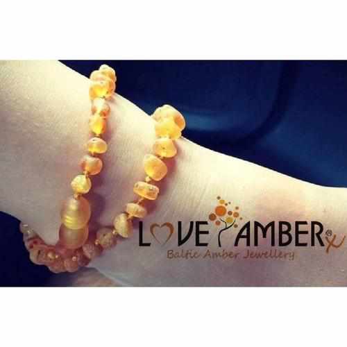 Child Bees Knees Raw Honey Baltic Amber Anklet Bracelet