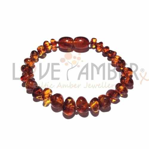 Child Brandy Snap Cognac Baltic Amber Anklet Bracelet